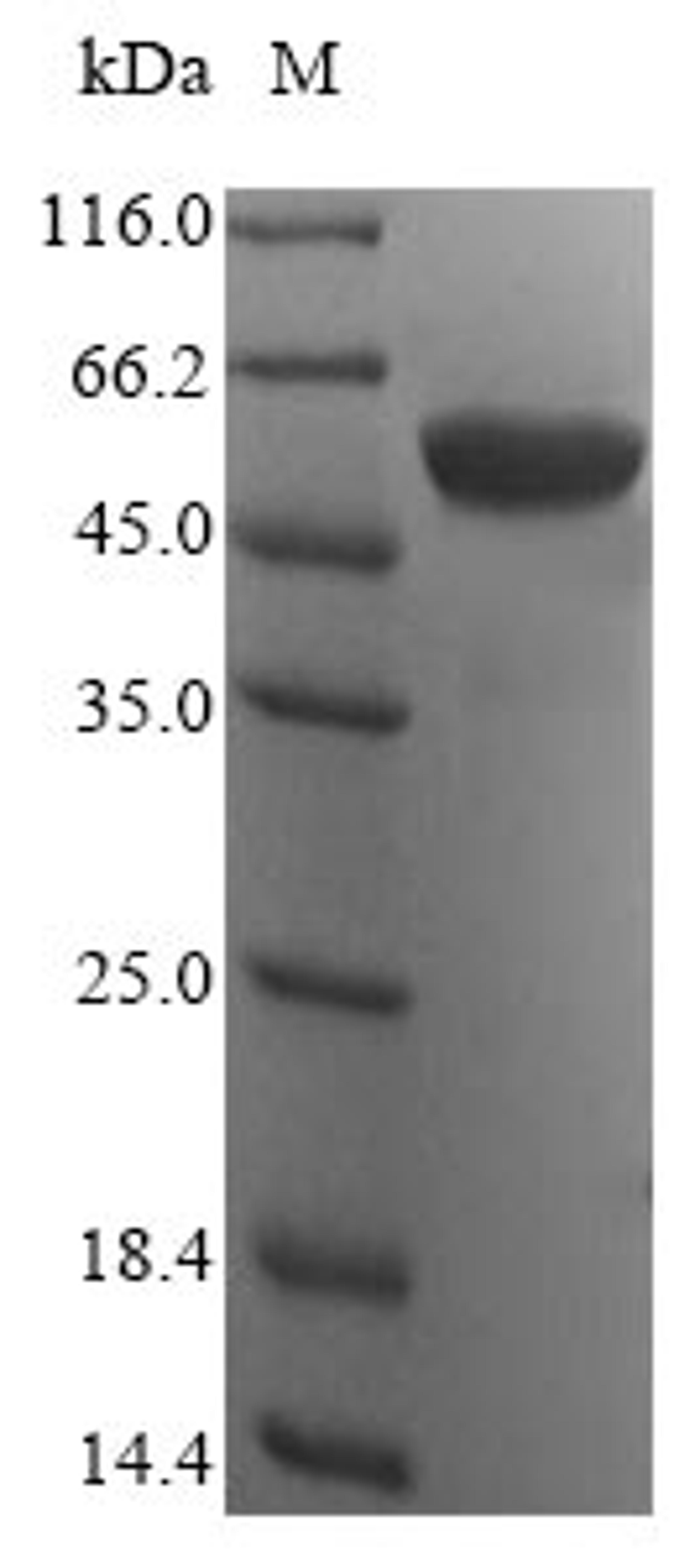 (Tris-Glycine gel) Discontinuous SDS-PAGE (reduced) with 5% enrichment gel and 15% separation gel.