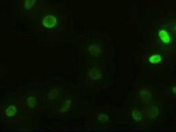 Immunocytochemistry/Immunofluorescence: Alpha Actinin 1 Antibody (7A4) [NBP1-48251] - Immunofluorescent staining of HeLa cells using anti-Alpha Actinin 1 mouse monoclonal antibody.