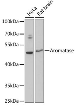 Western blot - Aromatase antibody (A12684)