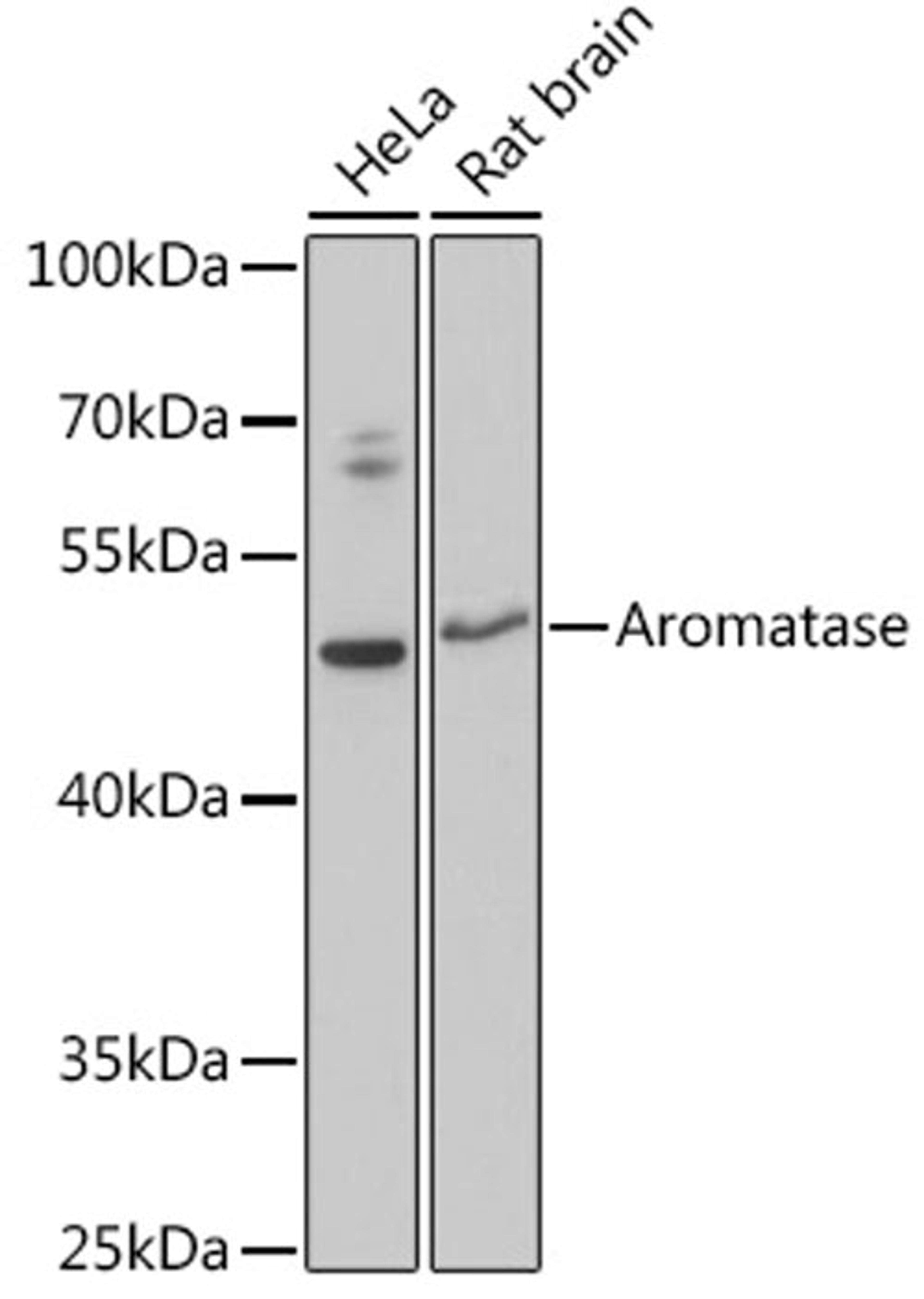 Western blot - Aromatase antibody (A12684)