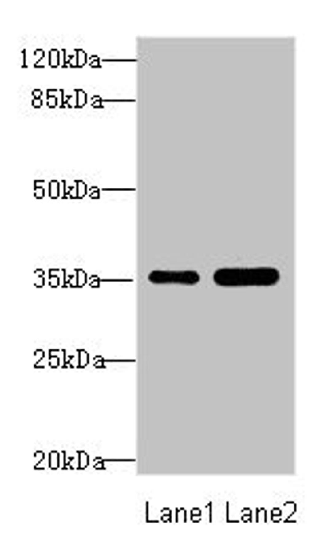 Western blot. All lanes: TOB2 antibody at 1.89ug/ml. Lane 1: Mouse skeletal muscle tissue. Lane 2: Mouse heart tissue. Secondary. Goat polyclonal to rabbit IgG at 1/10000 dilution. Predicted band size: 37, 28 kDa. Observed band size: 37 kDa.