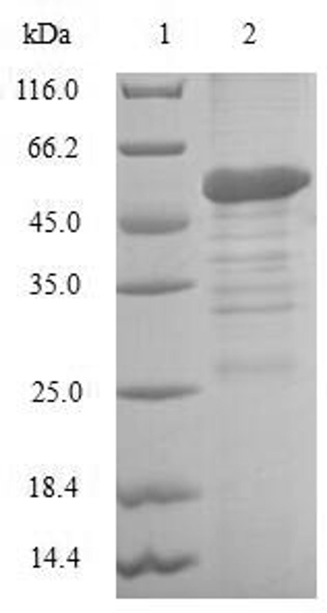 (Tris-Glycine gel) Discontinuous SDS-PAGE (reduced) with 5% enrichment gel and 15% separation gel.