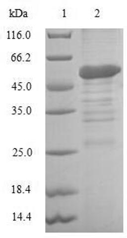 (Tris-Glycine gel) Discontinuous SDS-PAGE (reduced) with 5% enrichment gel and 15% separation gel.