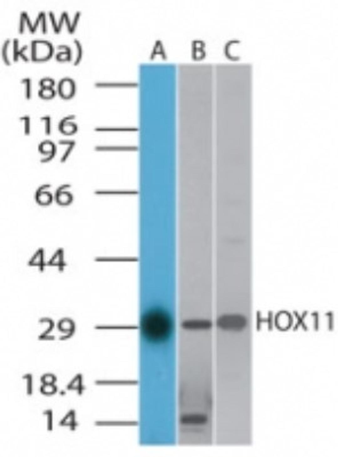 Western Blot: HOX11 Antibody [NB100-56424] - Annalysis of HOX11 in A) human, B) mouse and C) rat liver cell lysate using NB100-56424 at 1 ug/ml.