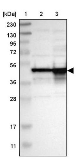 Western Blot: DAZAP1 Antibody [NBP1-82741] - Lane 1: Marker [kDa] 230, 130, 95, 72, 56, 36, 28, 17, 11<br/>Lane 2: Human cell line RT-4<br/>Lane 3: Human cell line U-251MG sp