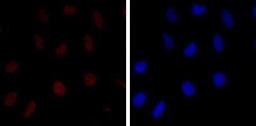 Immunocytochemistry/Immunofluorescence: KSHV K8 Antibody (8C12G10G1) [NB100-2189] - Immunofluorescence analysis of Hela cells using c-Jun Rabbit pAb (Red). Blue: DRAQ5 fluorescent DNA dye.