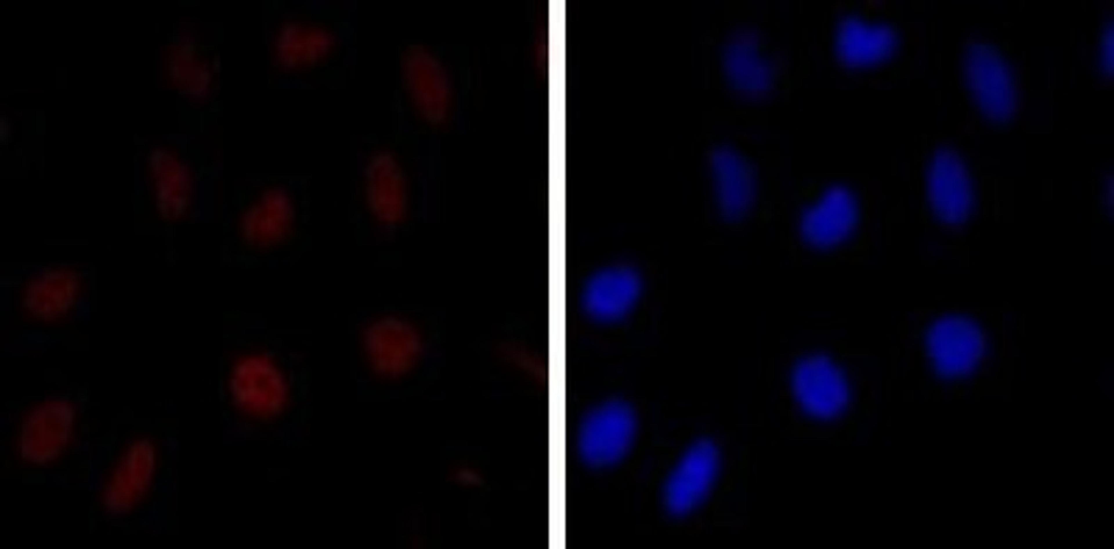 Immunocytochemistry/Immunofluorescence: KSHV K8 Antibody (8C12G10G1) [NB100-2189] - Immunofluorescence analysis of Hela cells using c-Jun Rabbit pAb (Red). Blue: DRAQ5 fluorescent DNA dye.