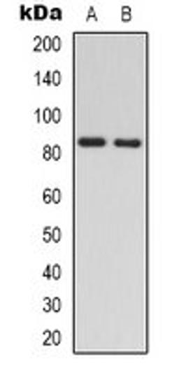 Western blot analysis of Jurkat (Lane 1), HEK293T (Lane 2) whole cell lysates using RAD54A antibody