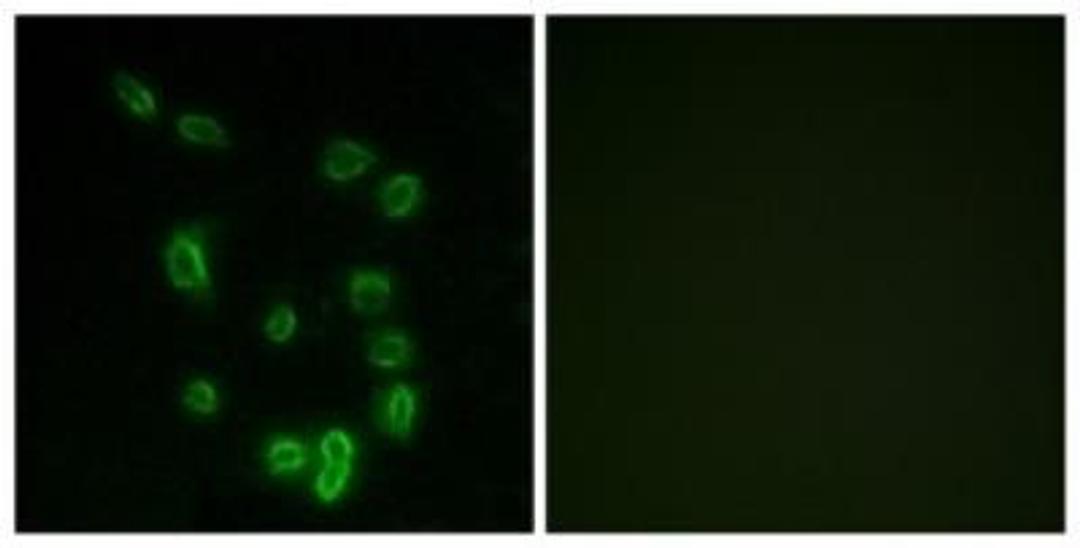 Immunocytochemistry/Immunofluorescence: DARPP-32 [p Thr34] Antibody [NBP1-60812] - Analysis of HepG2 cells, using DARPP32 (Phospho-Thr34) Antibody. The picture on the right is treated with the synthesized peptide.