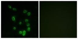 Immunocytochemistry/Immunofluorescence: DARPP-32 [p Thr34] Antibody [NBP1-60812] - Analysis of HepG2 cells, using DARPP32 (Phospho-Thr34) Antibody. The picture on the right is treated with the synthesized peptide.