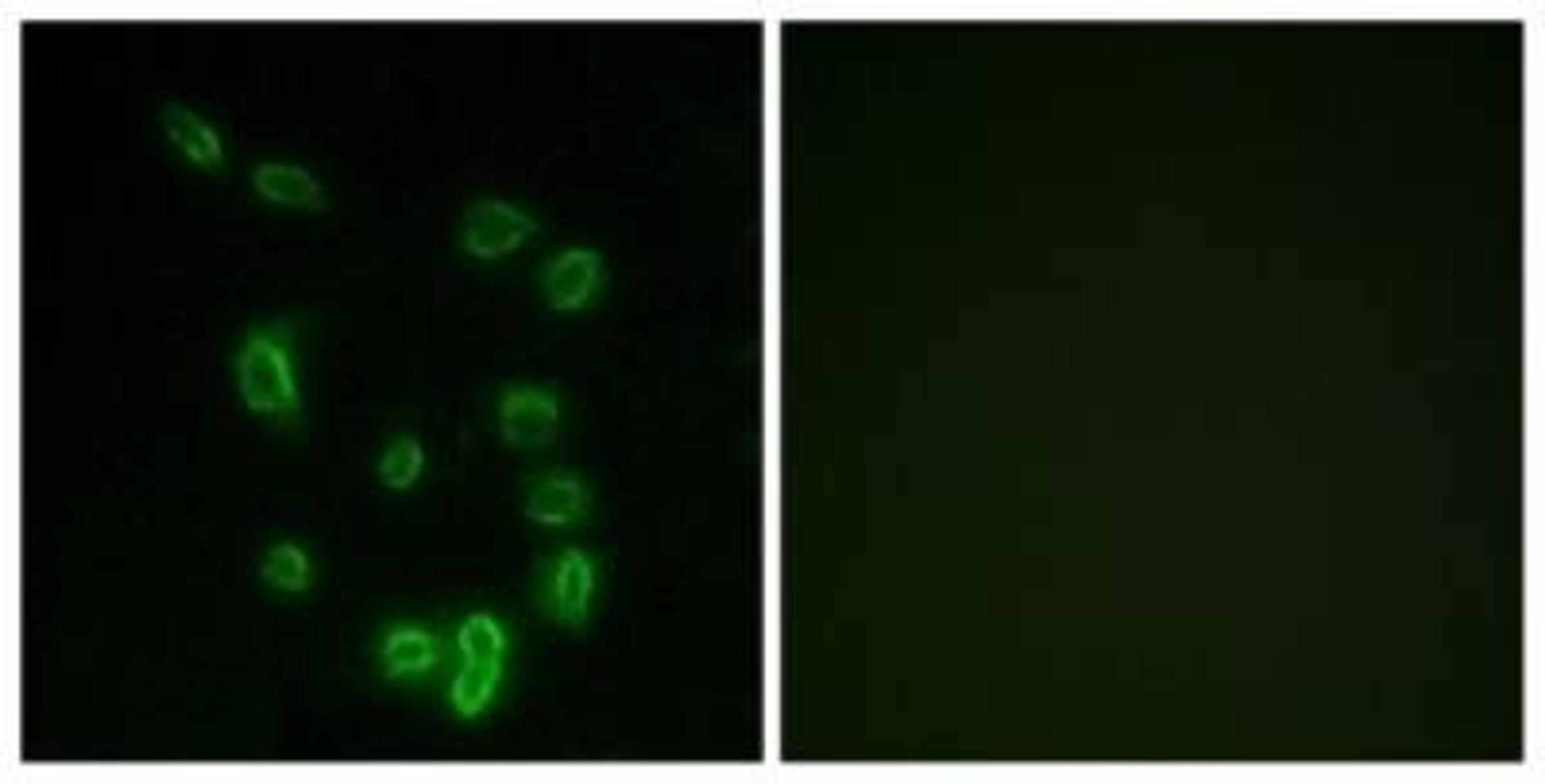 Immunocytochemistry/Immunofluorescence: DARPP-32 [p Thr34] Antibody [NBP1-60812] - Analysis of HepG2 cells, using DARPP32 (Phospho-Thr34) Antibody. The picture on the right is treated with the synthesized peptide.