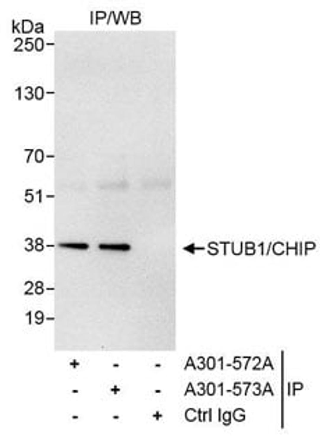 Detection of human STUB1/CHIP by western blot of immunoprecipitates.