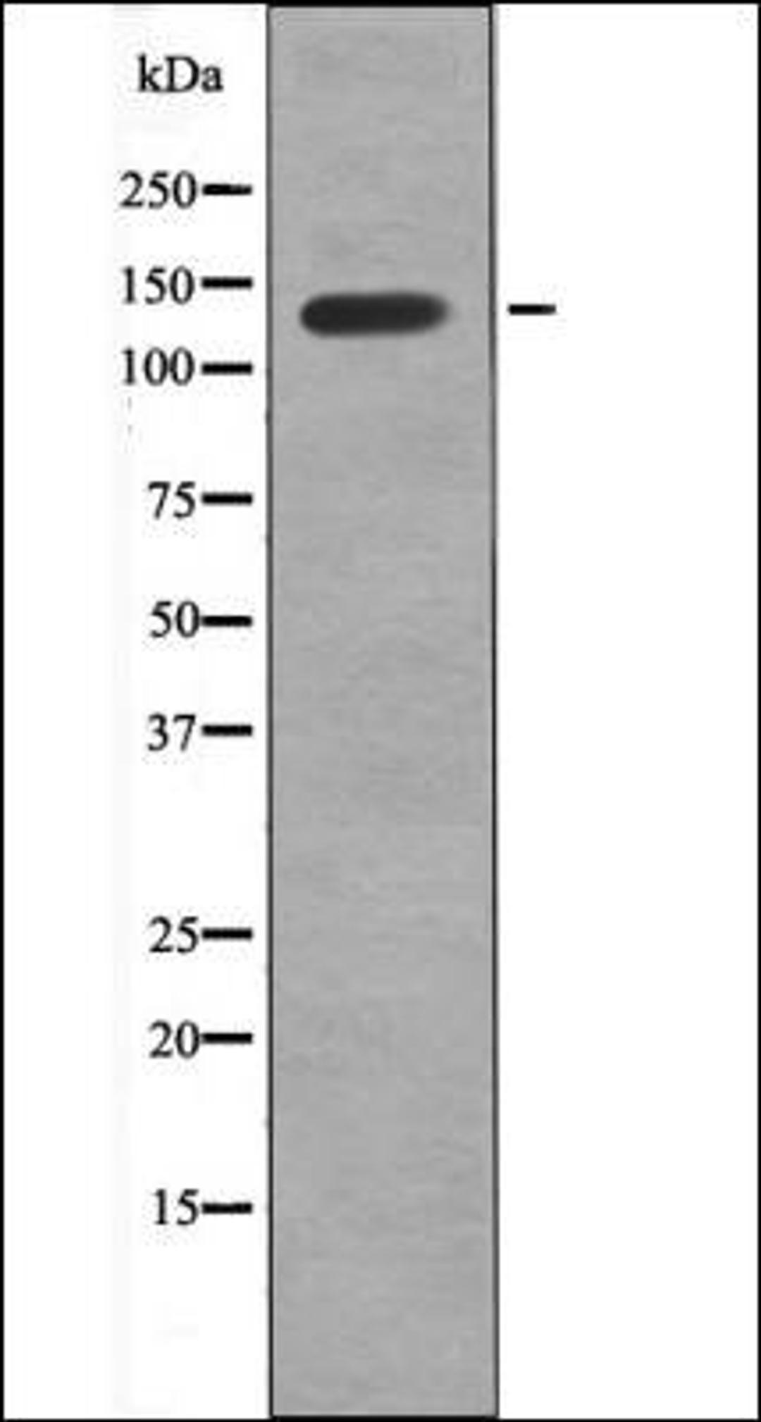 Western blot analysis of MDA-MB-435 whole cell lysates using VE-Cadherin -Phospho-Tyr658- antibody