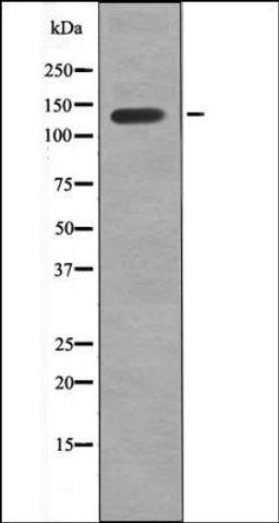 Western blot analysis of MDA-MB-435 whole cell lysates using VE-Cadherin -Phospho-Tyr658- antibody