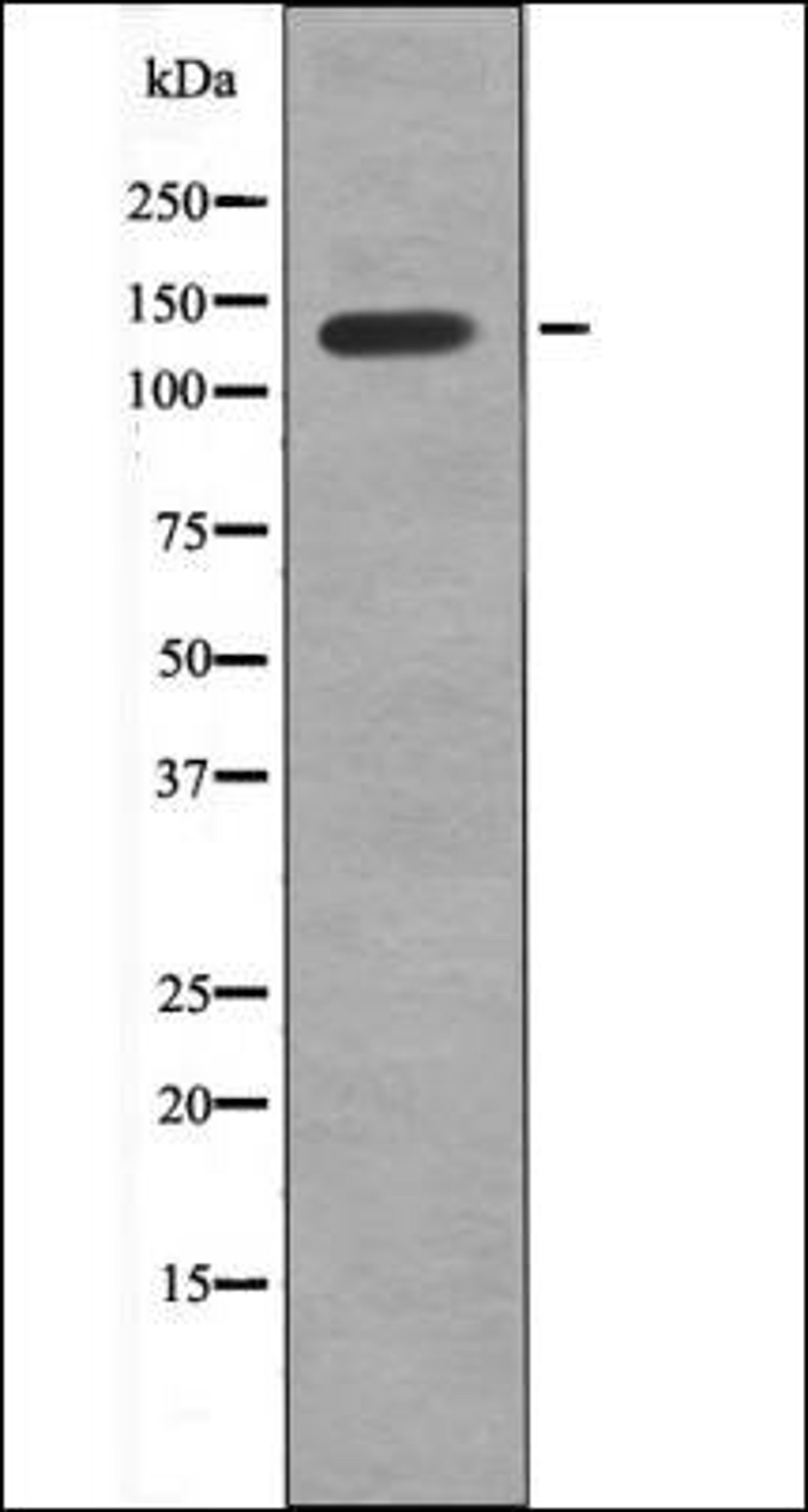 Western blot analysis of MDA-MB-435 whole cell lysates using VE-Cadherin -Phospho-Tyr658- antibody