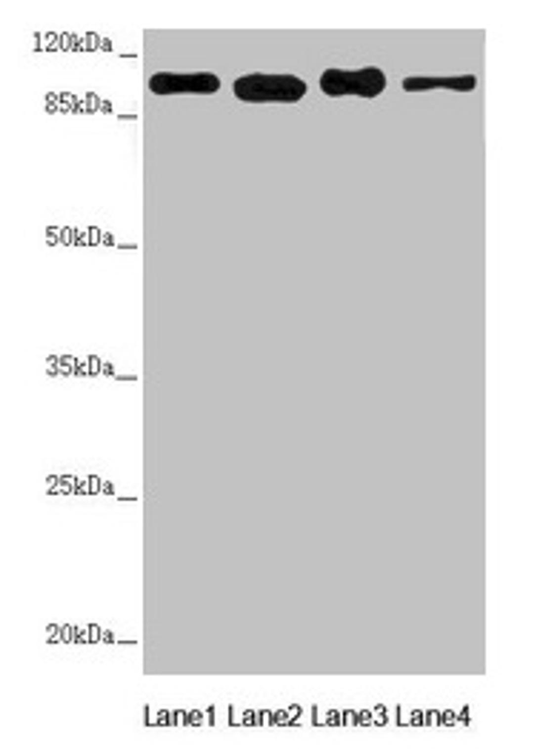 Western blot. All lanes: DHTKD1 antibody at 1.82µg/ml. Lane 1: Mouse heart tissue. Lane 2: A431 whole cell lysate. Lane 3: MCF-7 whole cell lysate. Lane 4: HepG2 whole cell lysate. Secondary. Goat polyclonal to rabbit IgG at 1/10000 dilution. Predicted band size: 103 kDa. Observed band size: 103 kDa