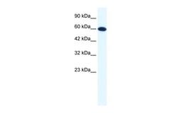 Antibody used in WB on Human HepG2 at 1.25 ug/ml.