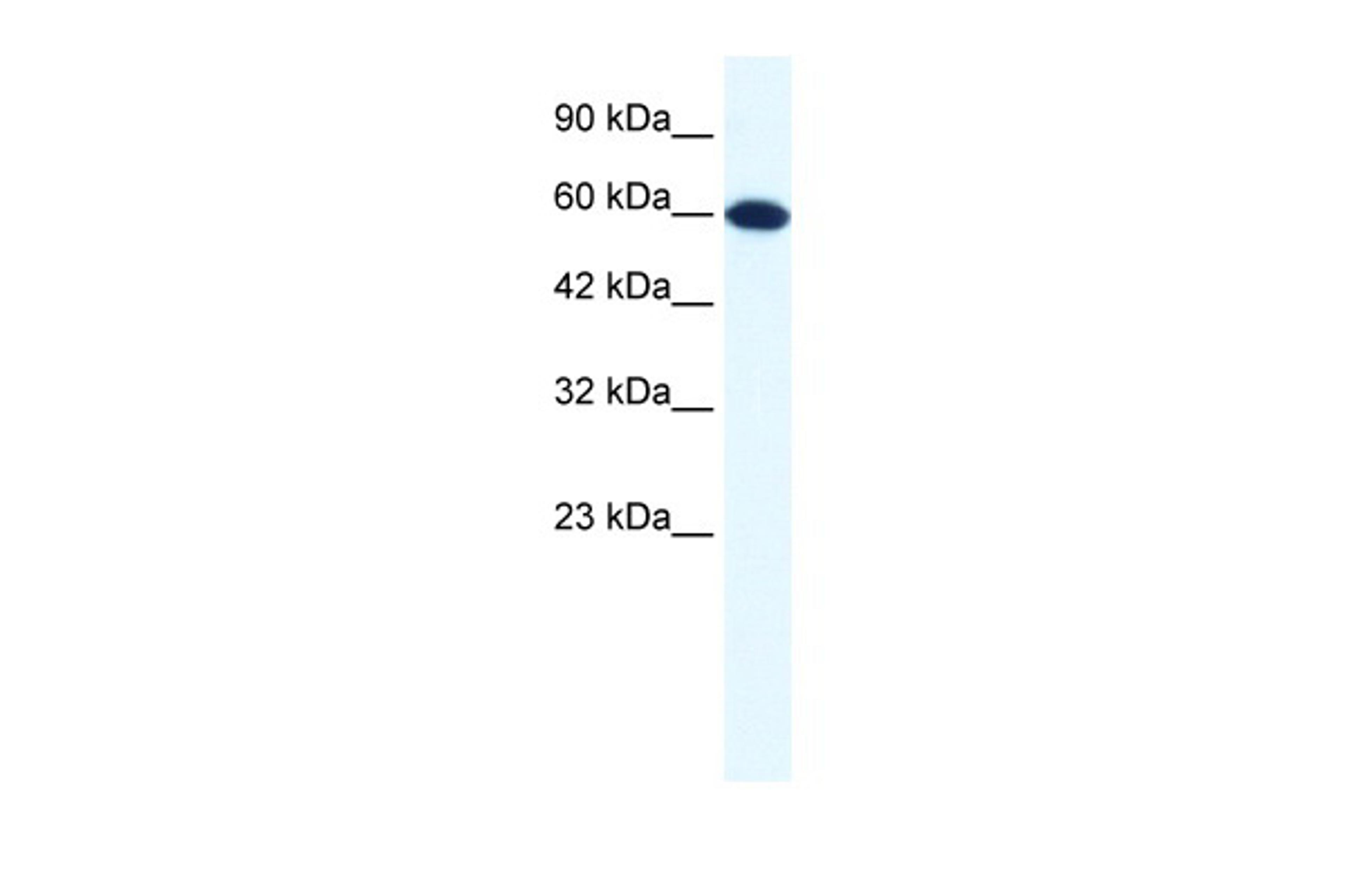 Antibody used in WB on Human HepG2 at 1.25 ug/ml.