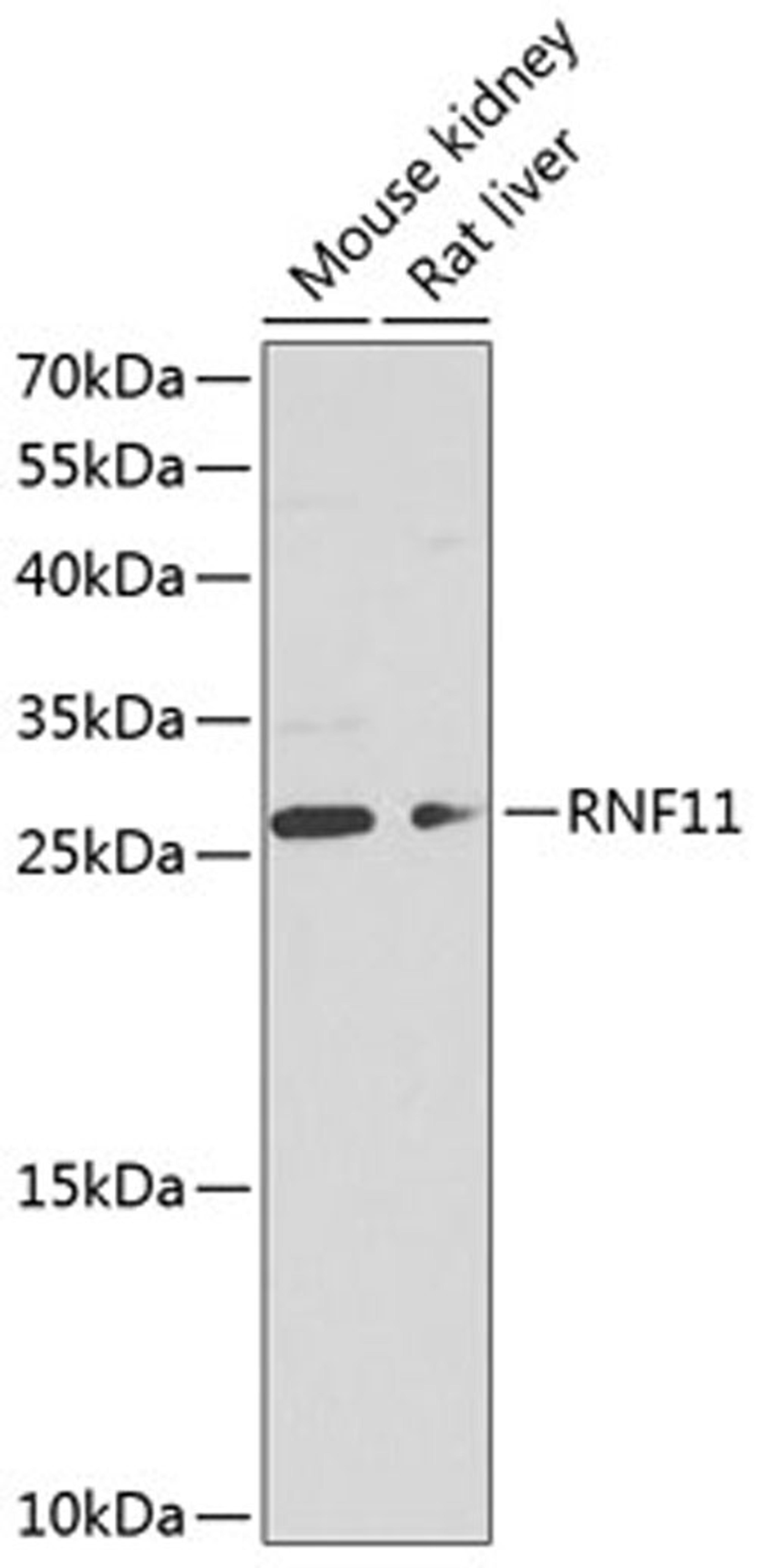 Western blot - RNF11 antibody (A8328)