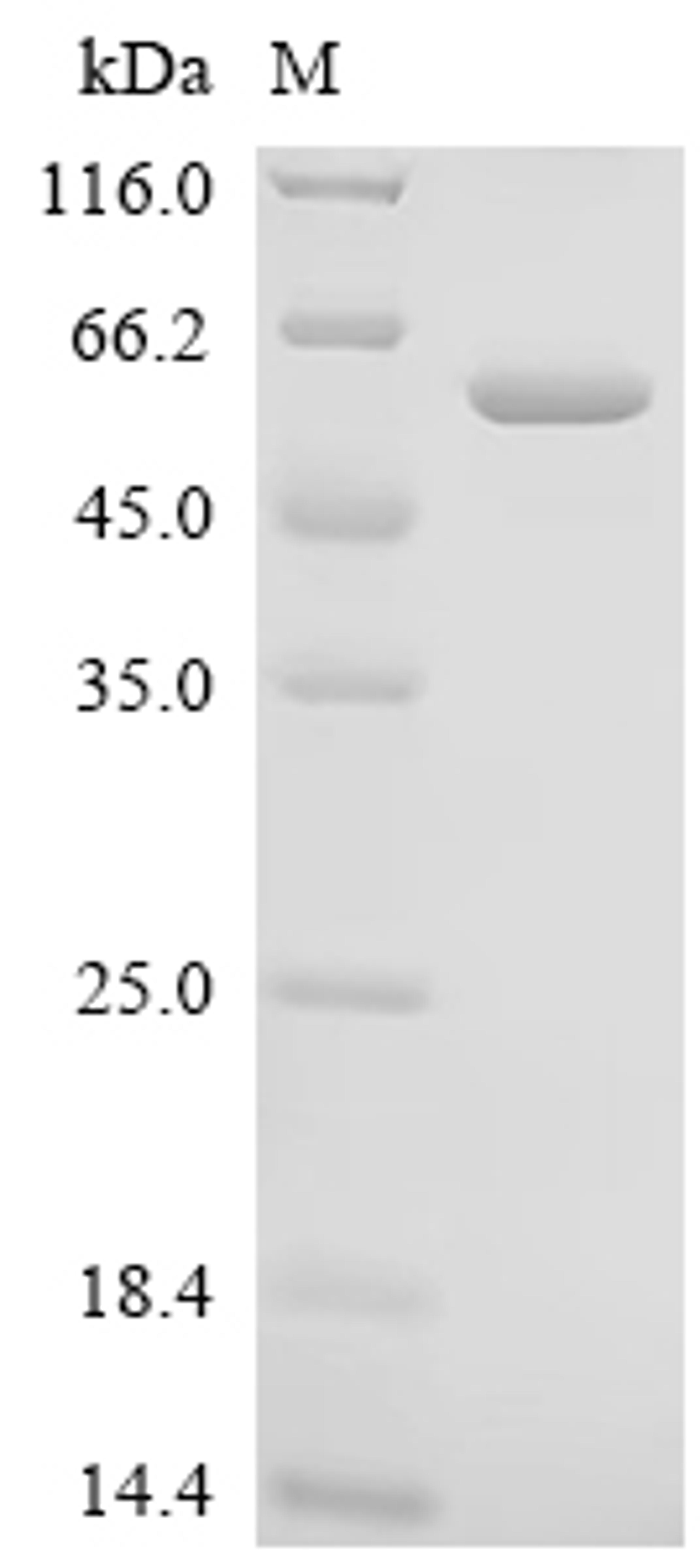 (Tris-Glycine gel) Discontinuous SDS-PAGE (reduced) with 5% enrichment gel and 15% separation gel.