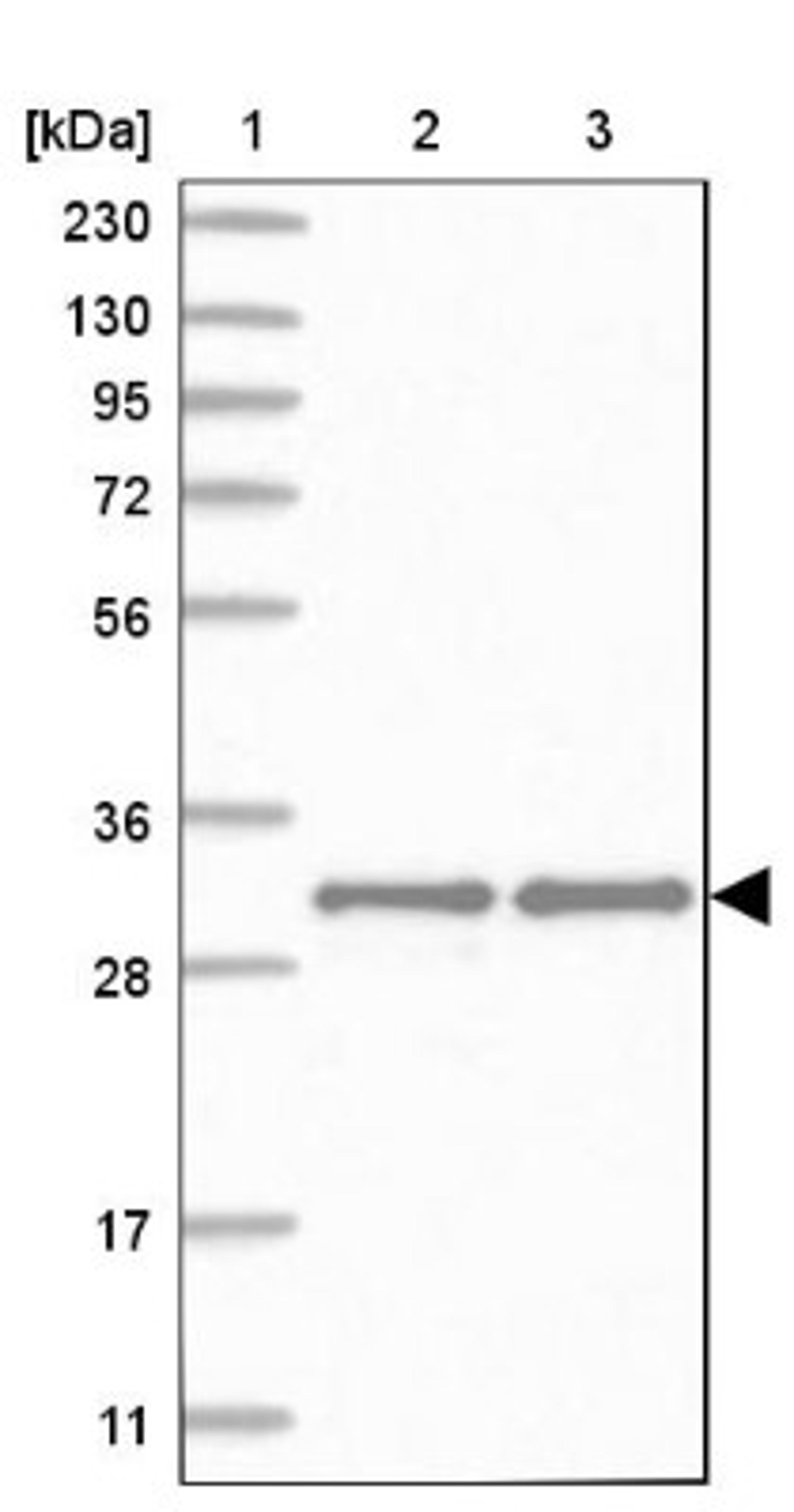 Western Blot: MAPK1IP1L Antibody [NBP1-88420] - Lane 1: Marker [kDa] 230, 130, 95, 72, 56, 36, 28, 17, 11<br/>Lane 2: Human cell line RT-4<br/>Lane 3: Human cell line U-251MG sp