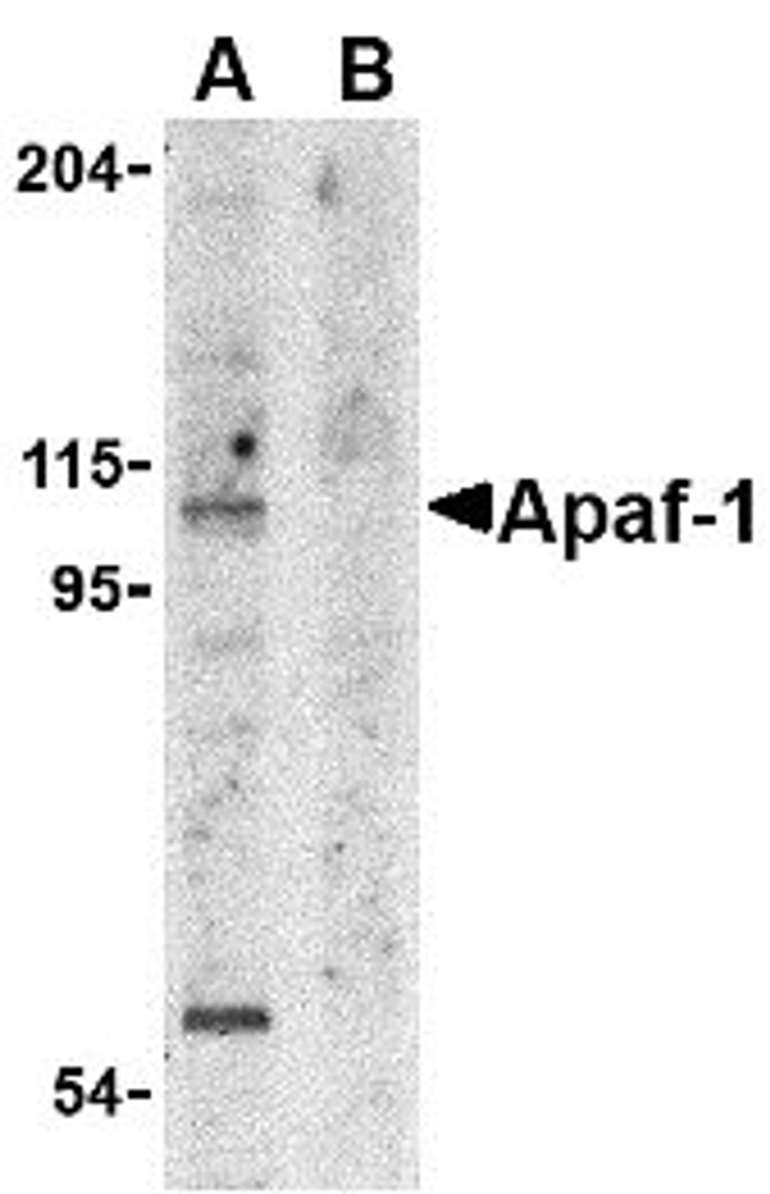 Western Blot analysis of whole cell lysate from K562 cells probed with Rabbit anti APAF1