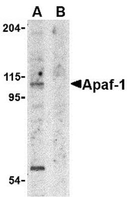 Western Blot analysis of whole cell lysate from K562 cells probed with Rabbit anti APAF1