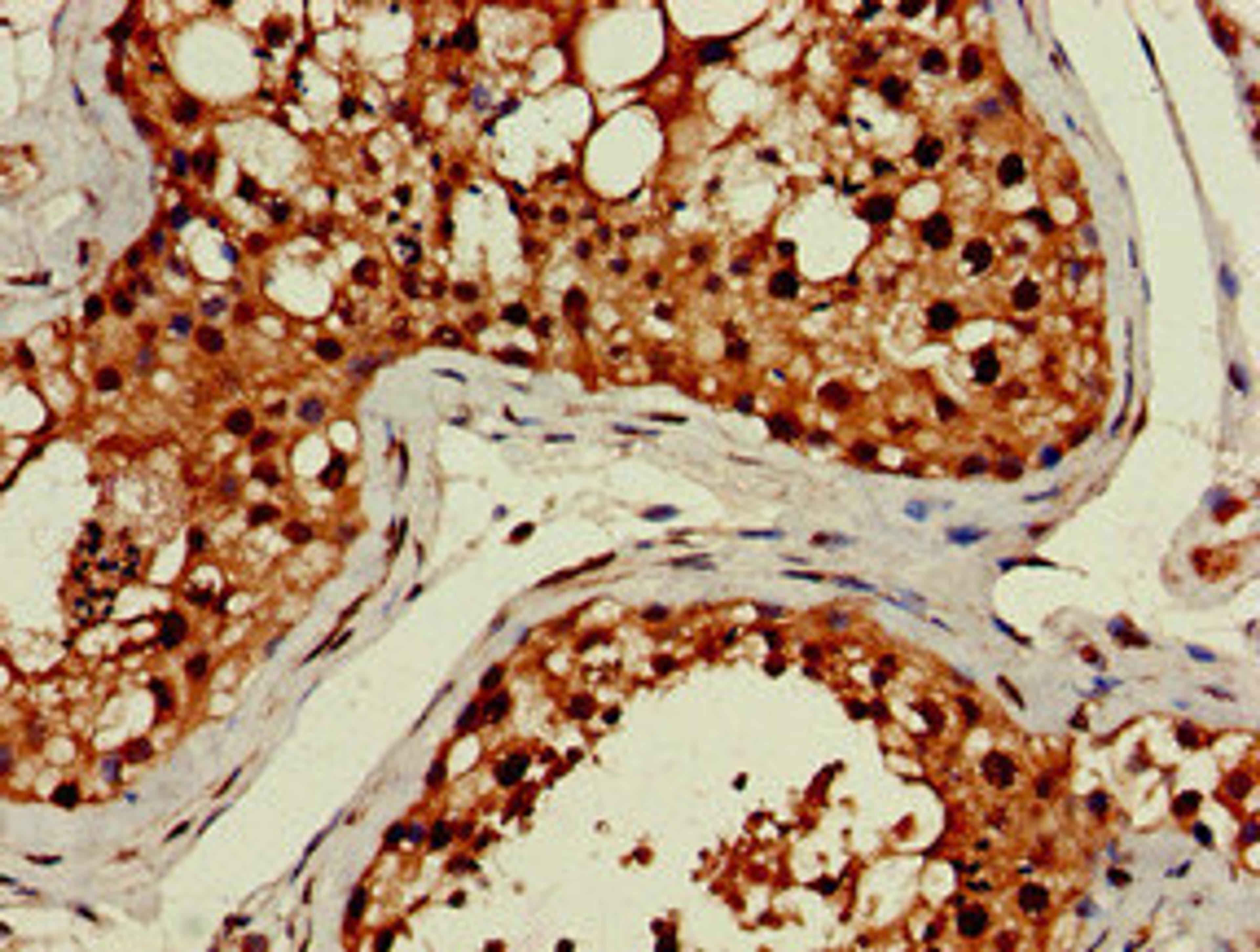 Immunohistochemistry of paraffin-embedded human testis tissue using CSB-PA844703LA01HU at dilution of 1:100