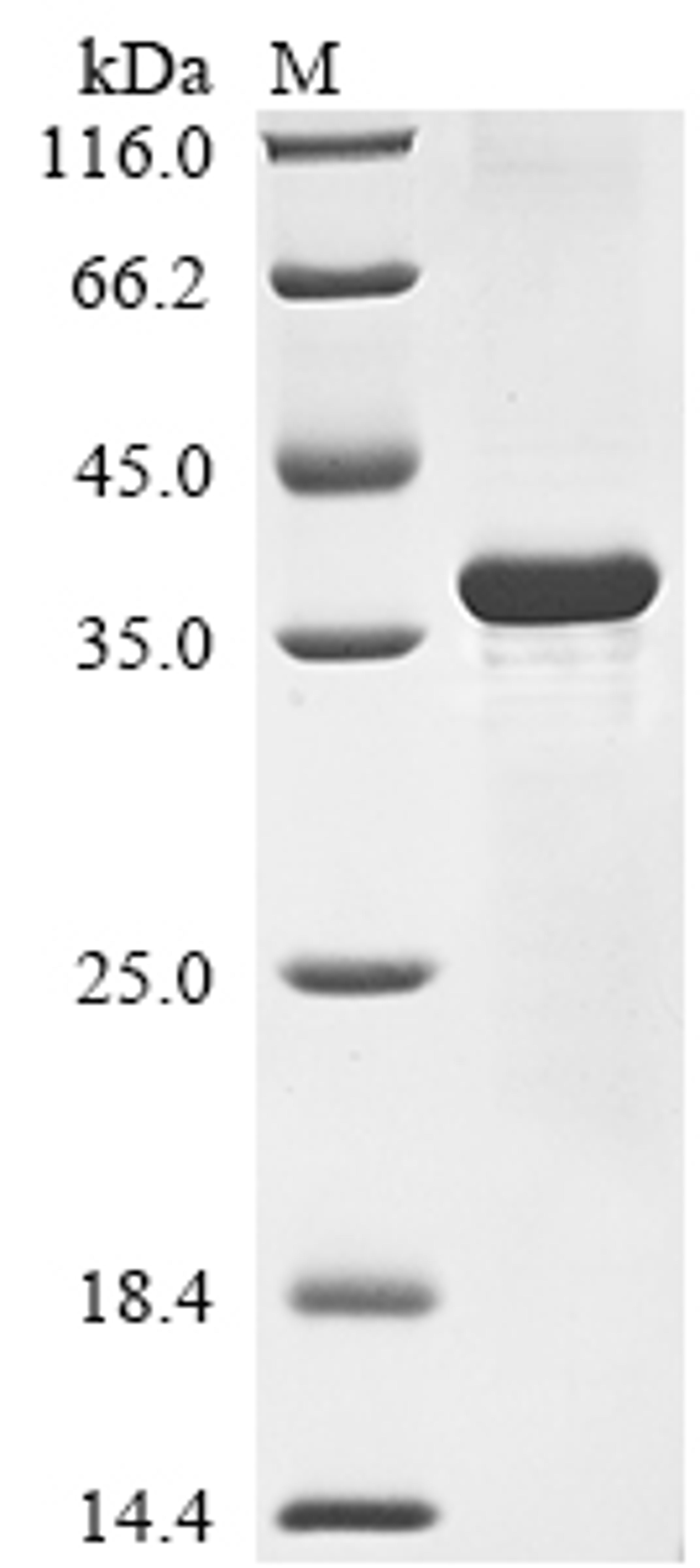 (Tris-Glycine gel) Discontinuous SDS-PAGE (reduced) with 5% enrichment gel and 15% separation gel.
