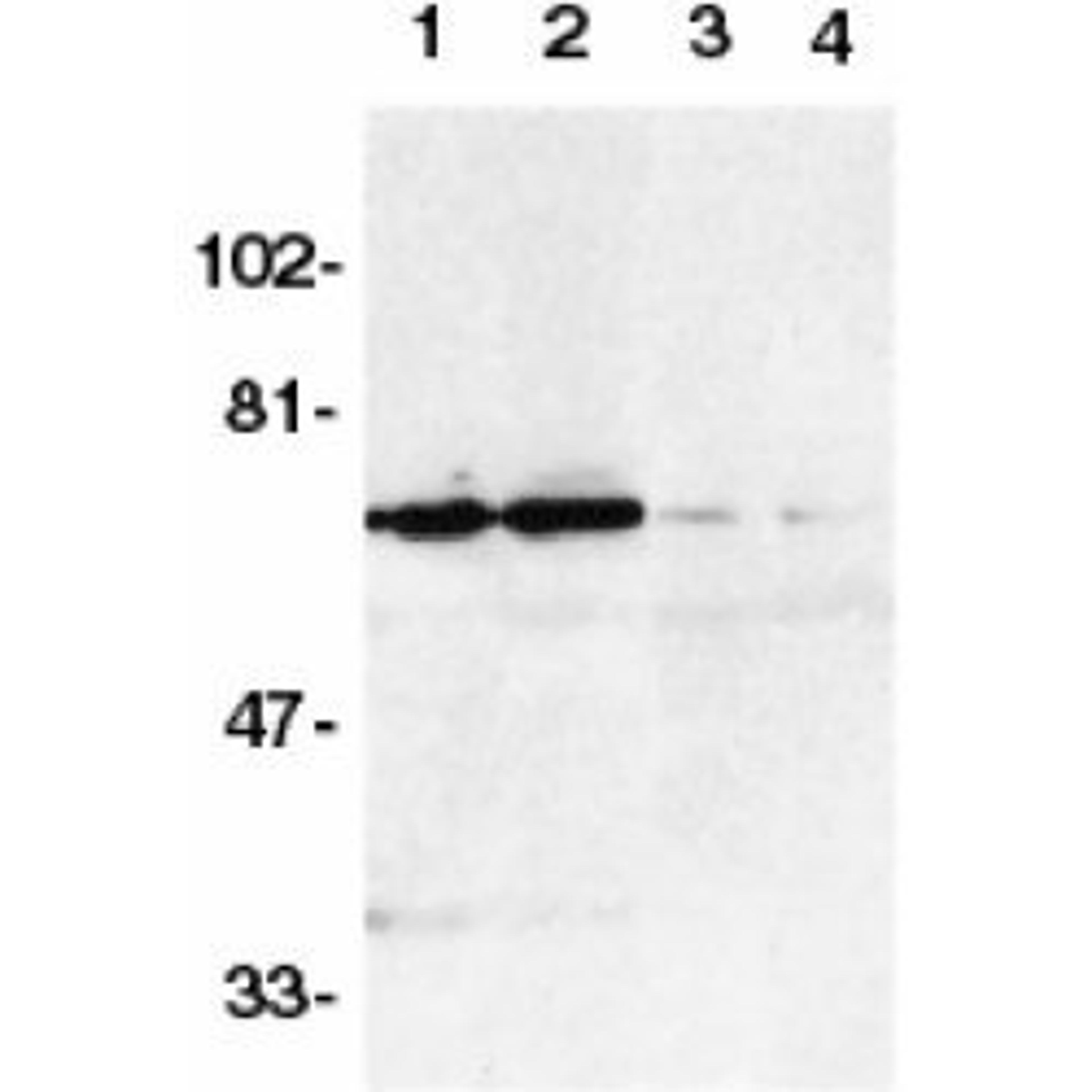 Western blot analysis of DR6 in K562 (1,3) and Raji (2,4) whole cell lysates