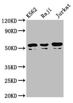 Western Blot. Positive WB detected in: K562 whole cell lysate, Raji whole cell lysate, Jurkat whole cell lysate. All lanes: TOX2 antibody at 4.3µg/ml. Secondary. Goat polyclonal to rabbit IgG at 1/50000 dilution. Predicted band size: 52, 55, 50, 54 kDa. Observed band size: 52, 50 kDa