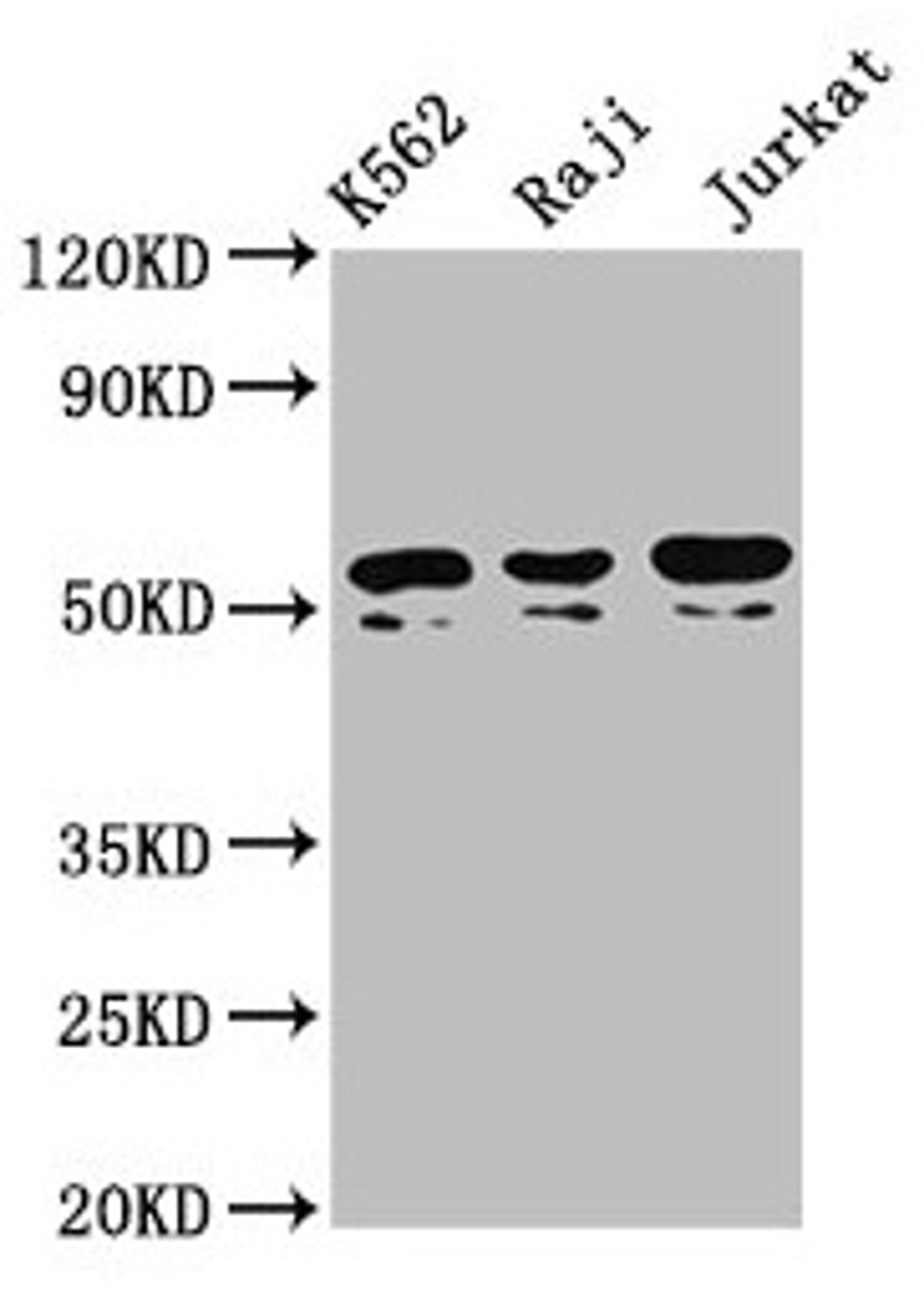 Western Blot. Positive WB detected in: K562 whole cell lysate, Raji whole cell lysate, Jurkat whole cell lysate. All lanes: TOX2 antibody at 4.3µg/ml. Secondary. Goat polyclonal to rabbit IgG at 1/50000 dilution. Predicted band size: 52, 55, 50, 54 kDa. Observed band size: 52, 50 kDa