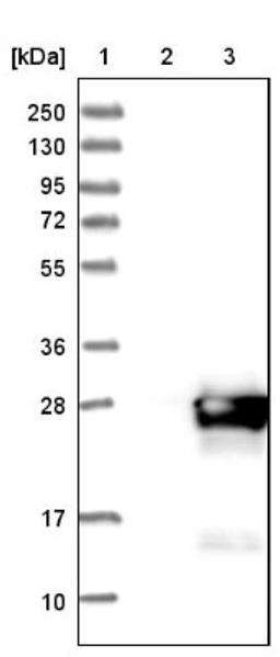 Western Blot: COMMD9 Antibody [NBP1-82027] - Lane 1: Marker [kDa] 250, 130, 95, 72, 55, 36, 28, 17, 10<br/>Lane 2: Negative control (vector only transfected HEK293T lysate)<br/>Lane 3: Over-expression lysate (Co-expressed with a C-terminal myc-DDK tag (~3.1 kDa) in mammalian HEK293T cells, LY415448)