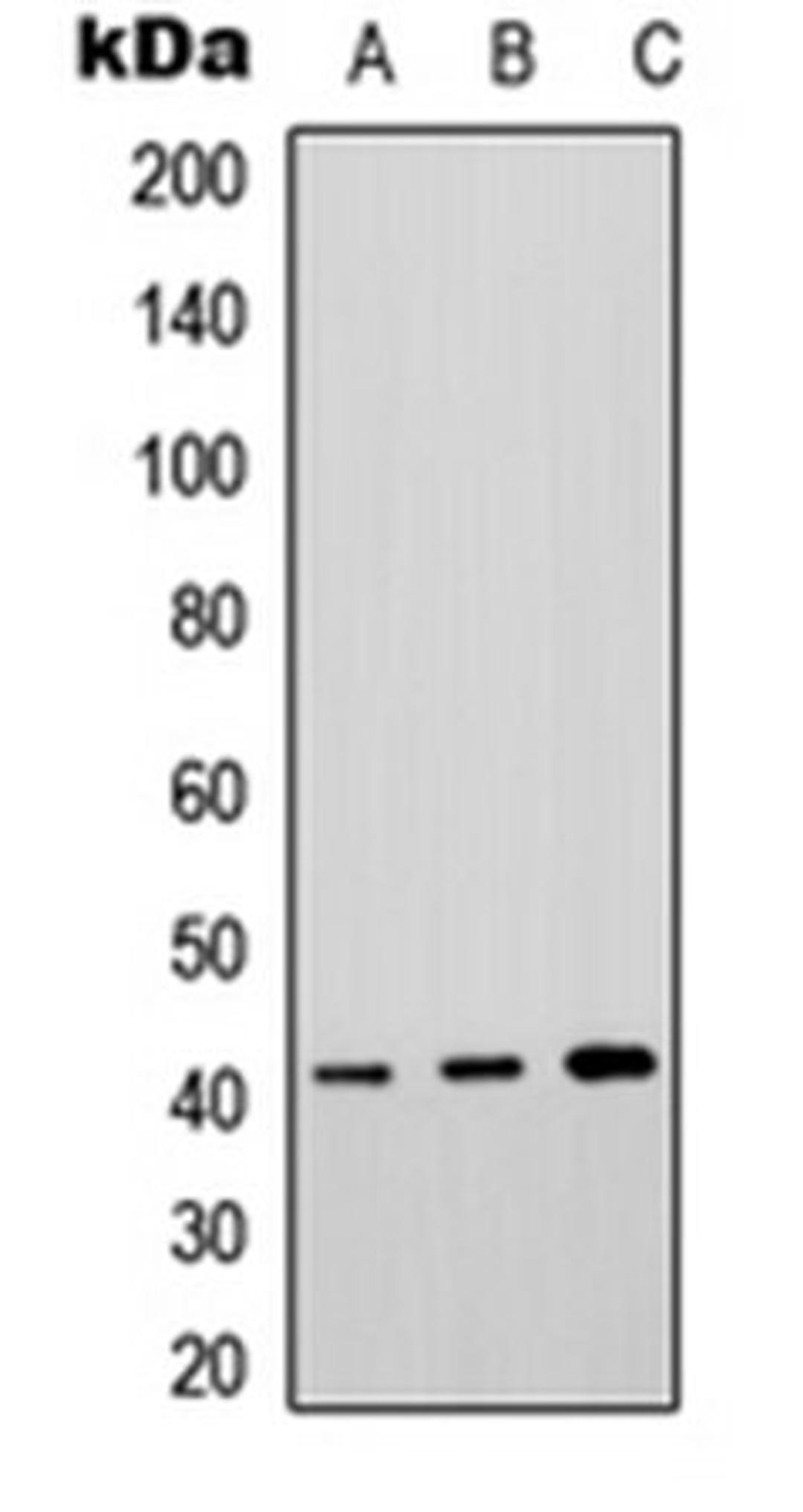 Western blot analysis of HeLa (Lane 1), rat brain (Lane 2), rat lung (Lane 3) whole cell lysates using P2Y4 antibody