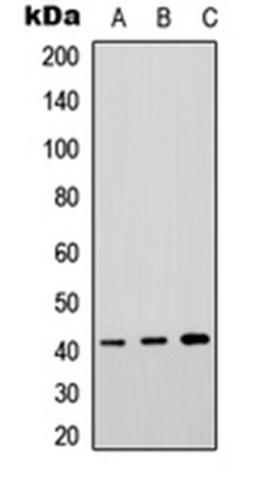 Western blot analysis of HeLa (Lane 1), rat brain (Lane 2), rat lung (Lane 3) whole cell lysates using P2Y4 antibody