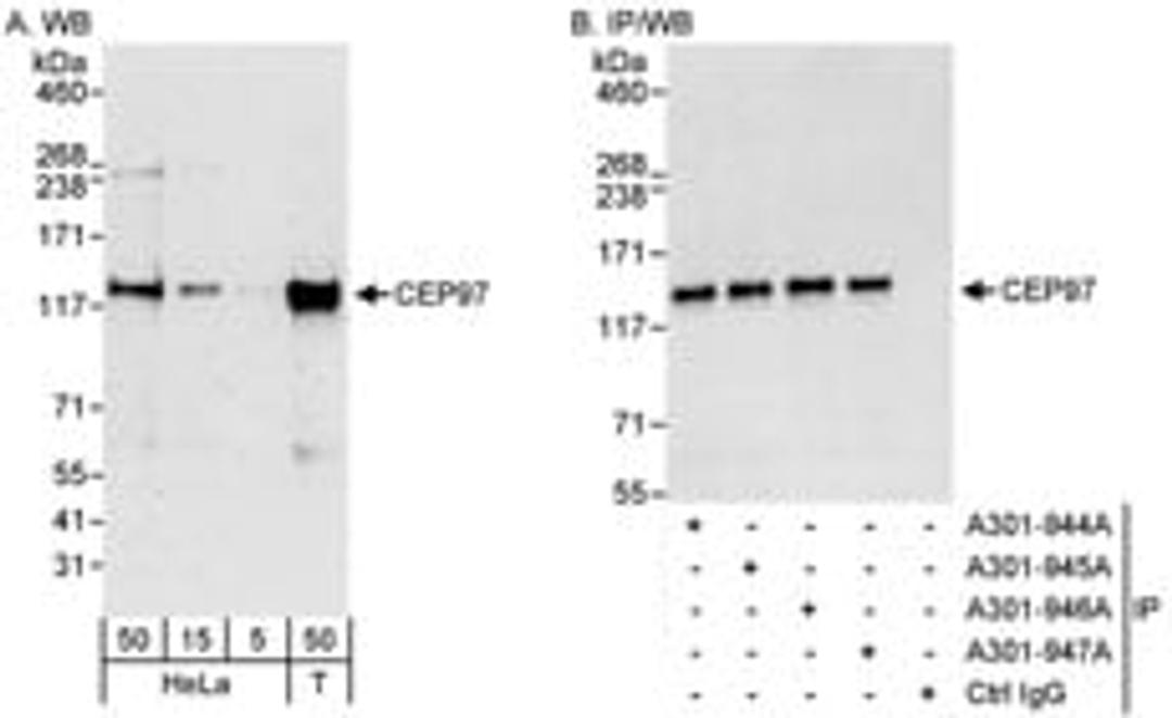 Detection of human CEP97 by western blot and immunoprecipitation.