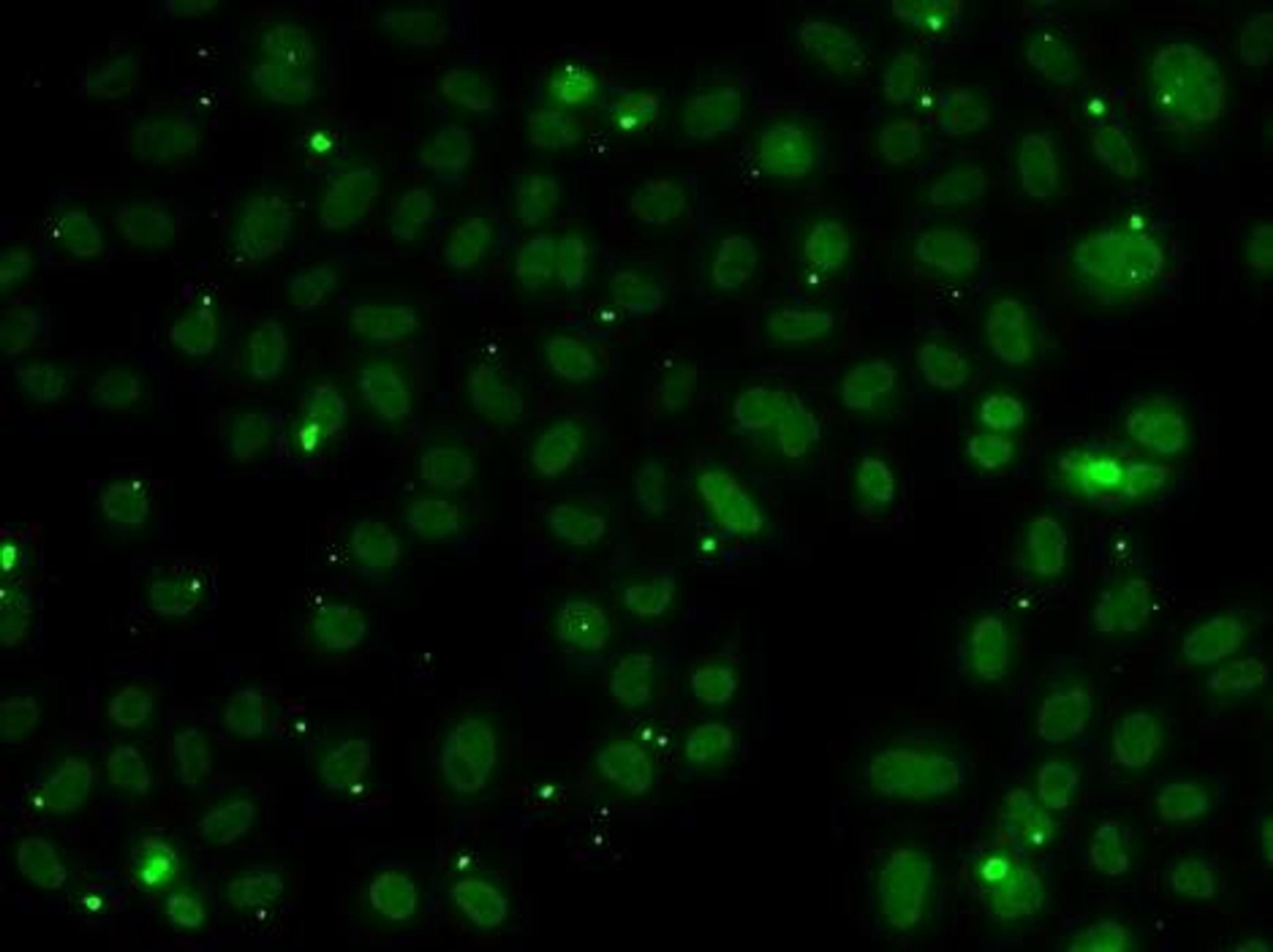 Immunofluorescence analysis of A549 cell using NSL1 antibody