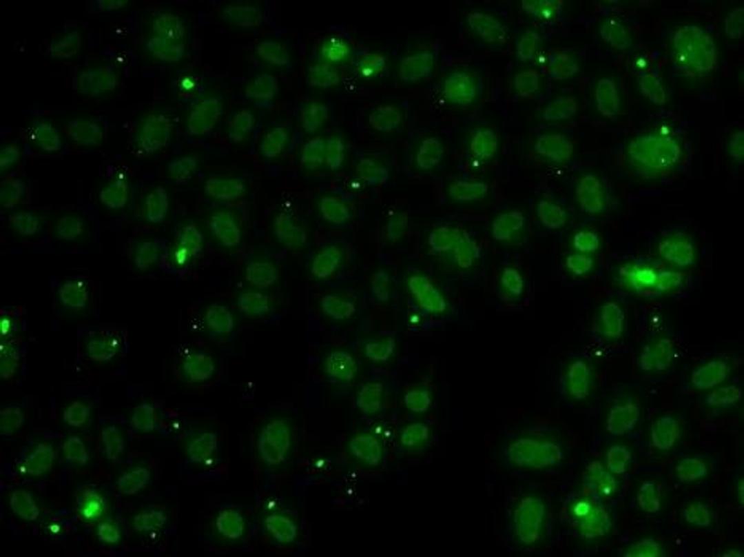 Immunofluorescence analysis of A549 cell using NSL1 antibody
