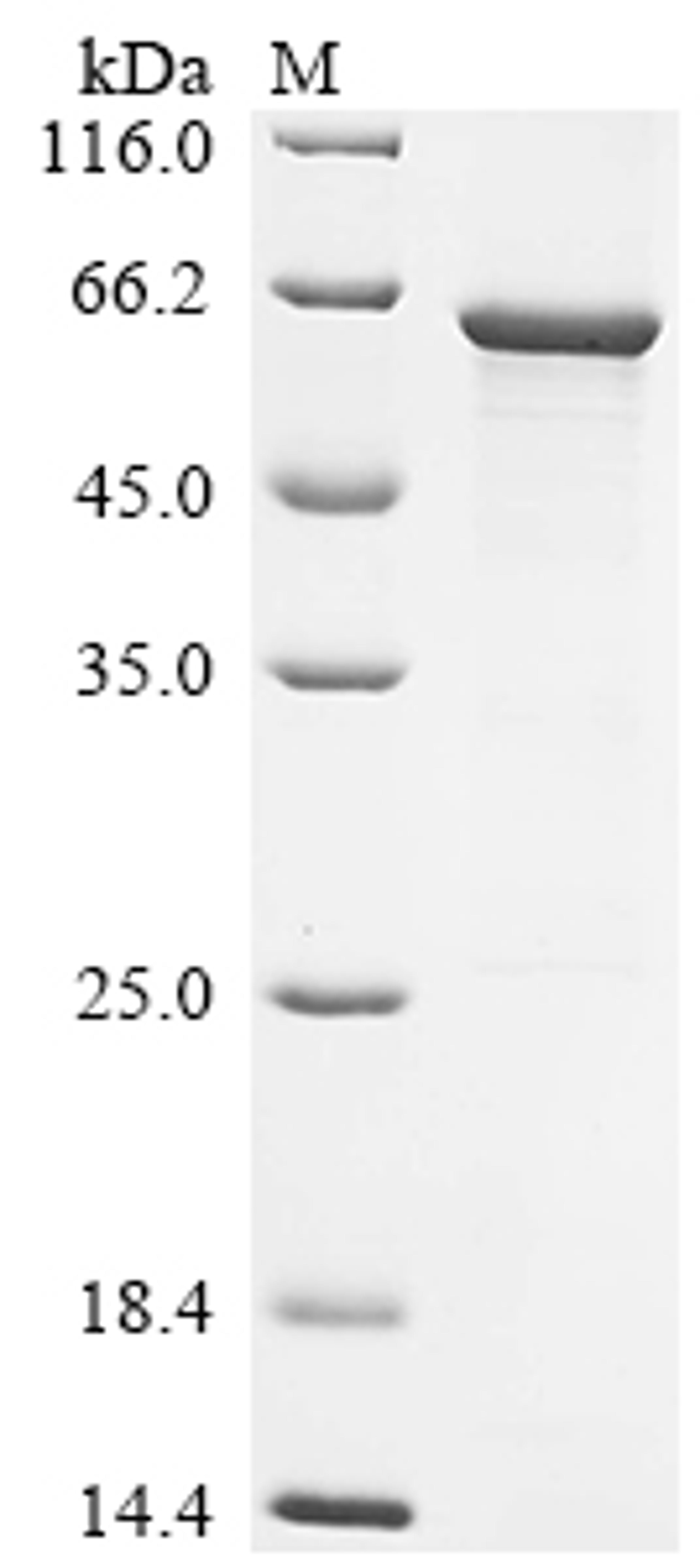 (Tris-Glycine gel) Discontinuous SDS-PAGE (reduced) with 5% enrichment gel and 15% separation gel.