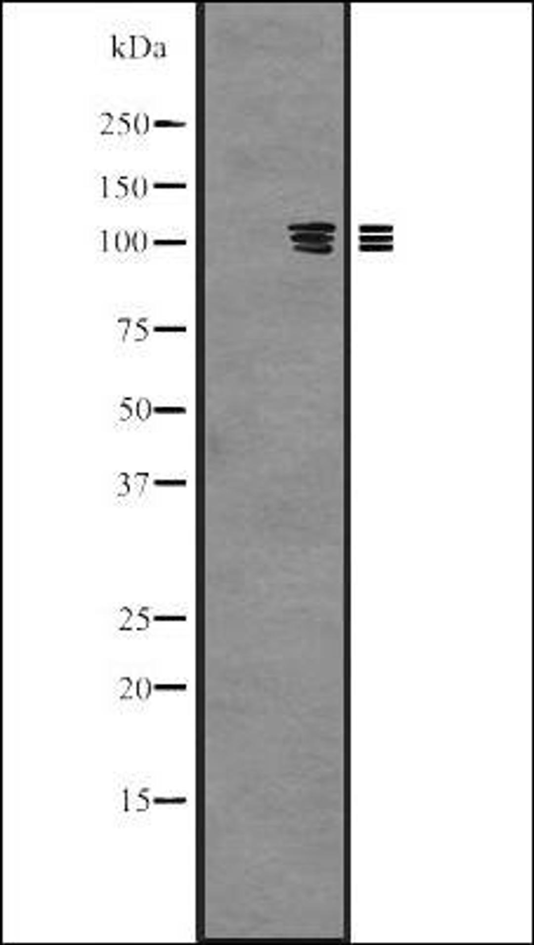 Western blot analysis of Hela cell lysate using PKN3 antibody