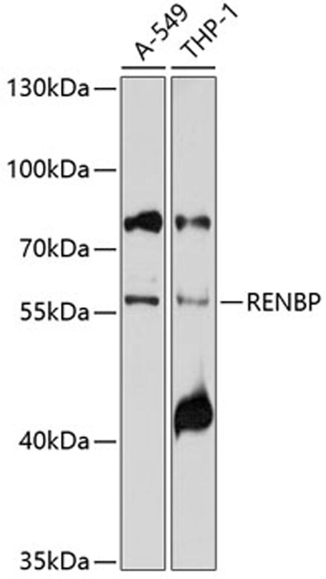 Western blot - RENBP antibody (A10012)