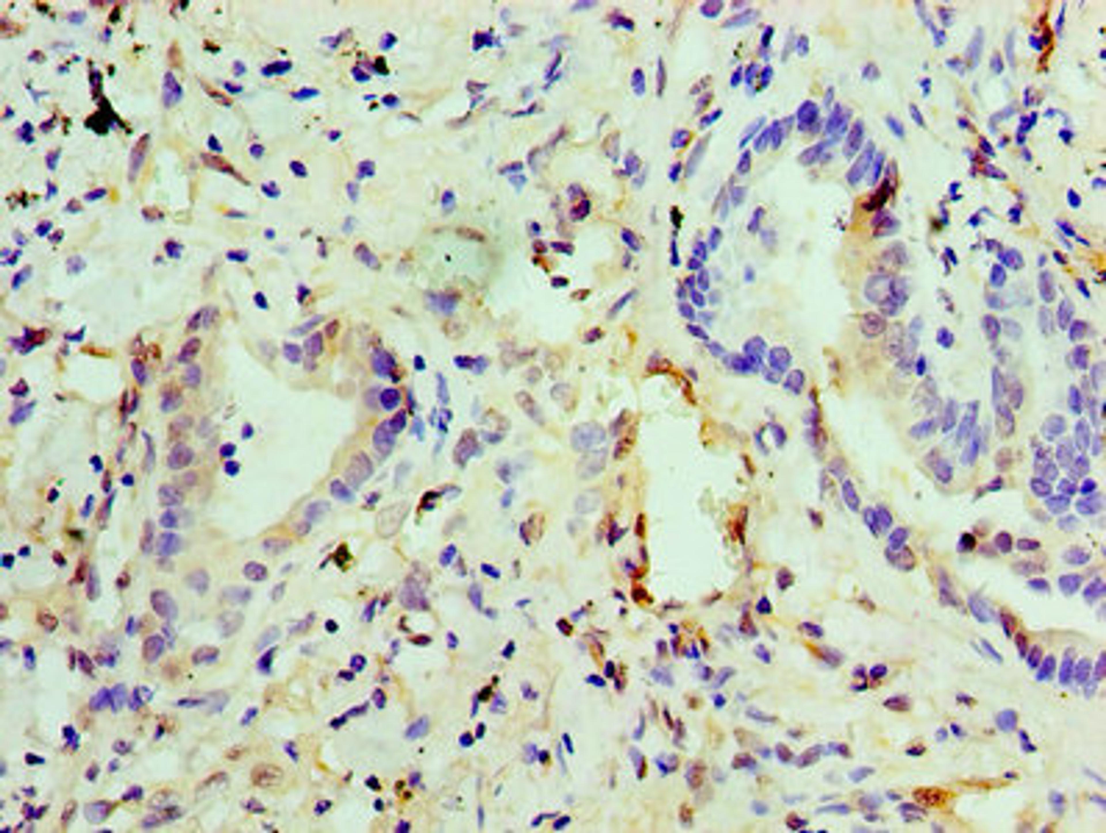 Immunohistochemistry of paraffin-embedded human lung tissue using CSB-PA007482EA01HU at dilution of 1:100