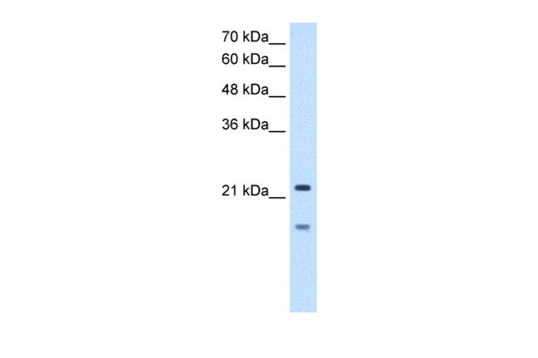 Antibody used in WB on Human HepG2 at 2.5 ug/ml.