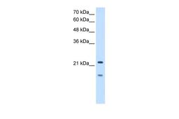 Antibody used in WB on Human HepG2 at 2.5 ug/ml.