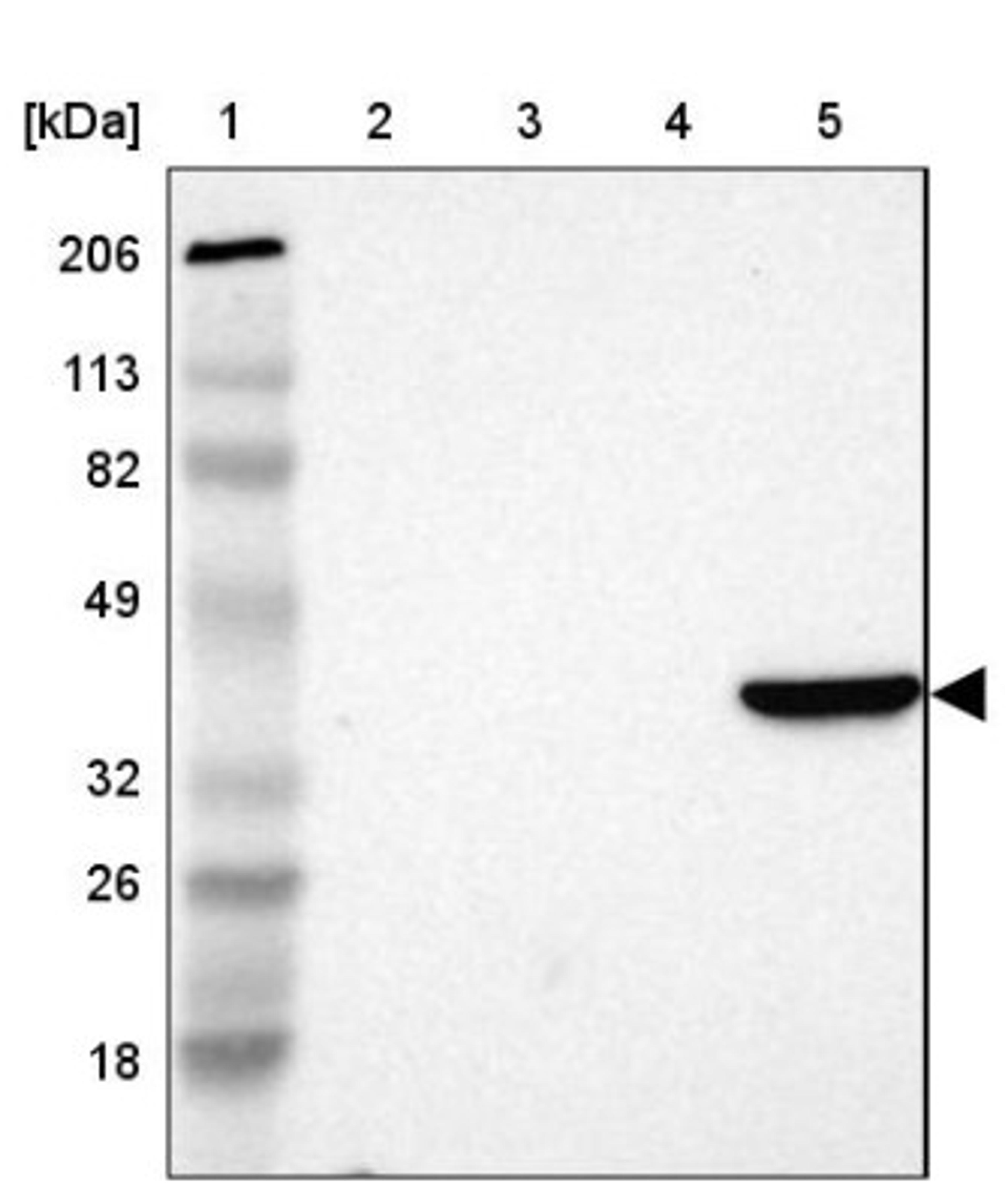 Western Blot: Aldolase B Antibody [NBP1-87494] - Lane 1: Marker [kDa] 206, 113, 82, 49, 32, 26, 18<br/>Lane 2: Human cell line RT-4<br/>Lane 3: Human cell line U-251MG sp<br/>Lane 4: Human cell line A-431<br/>Lane 5: Human liver tissue