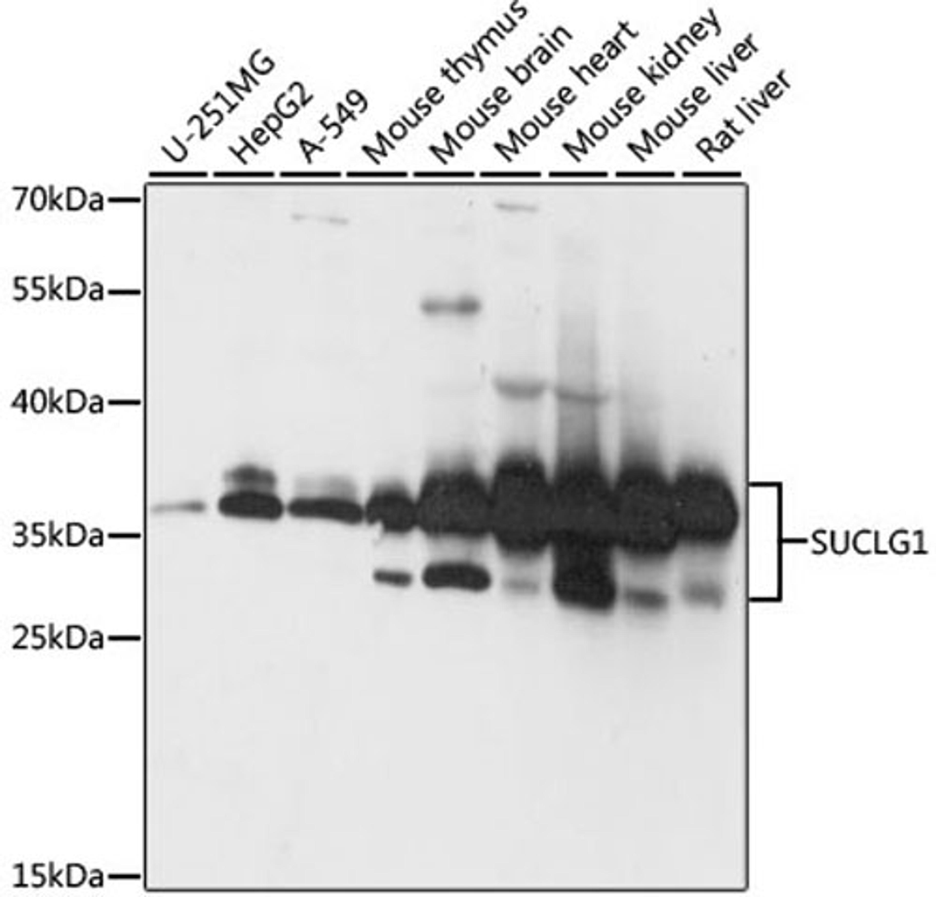 Western blot - SUCLG1 antibody (A15345)