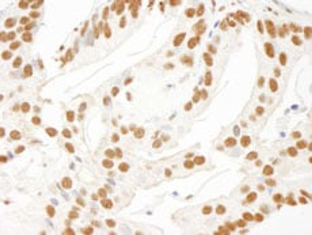 Detection of human KSRP by immunohistochemistry.