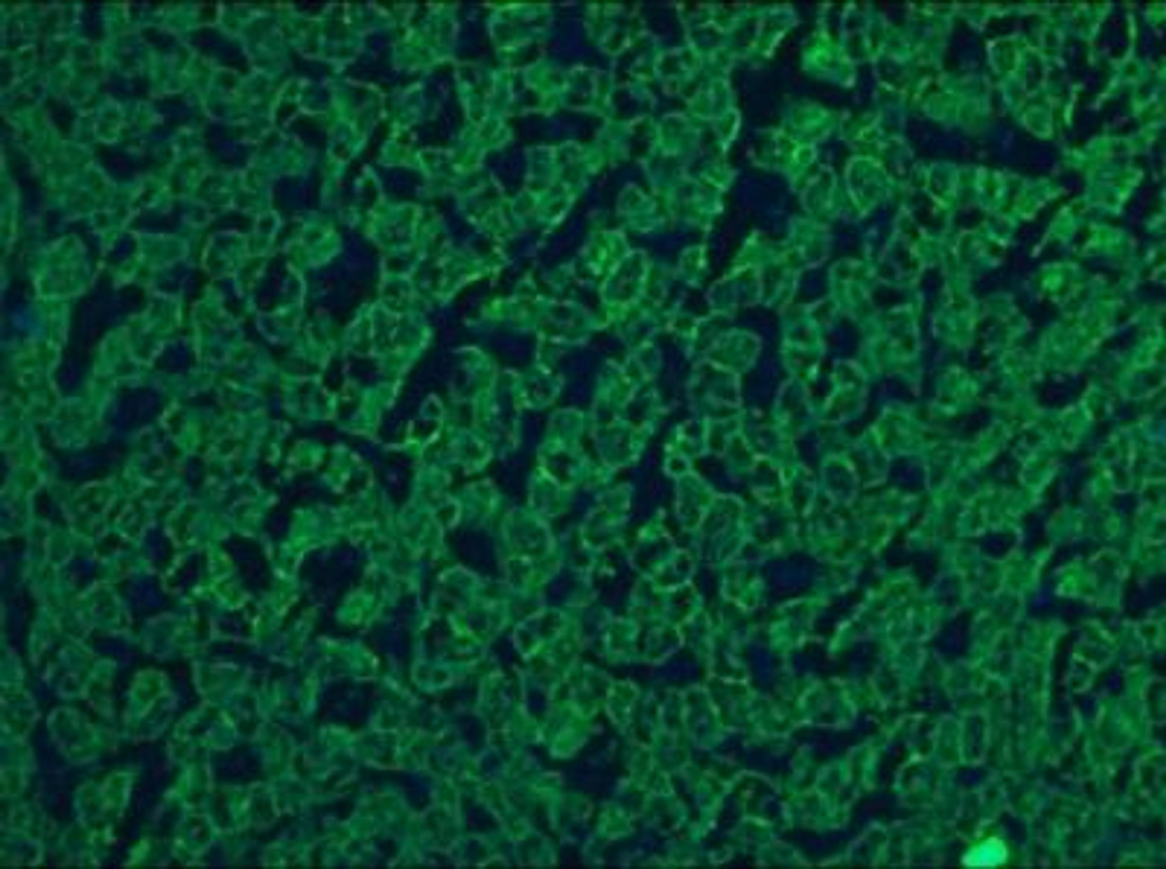 Immunocytochemistry/Immunofluorescence: Cytokeratin 5/8 Antibody (RCK102) [NBP1-97730] - Immunohistochemistry on frozen sections of human liver hepatocytes