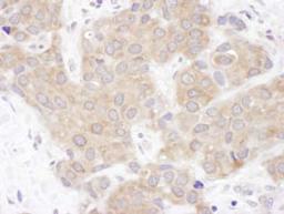 Detection of human VCIP135 by immunohistochemistry.