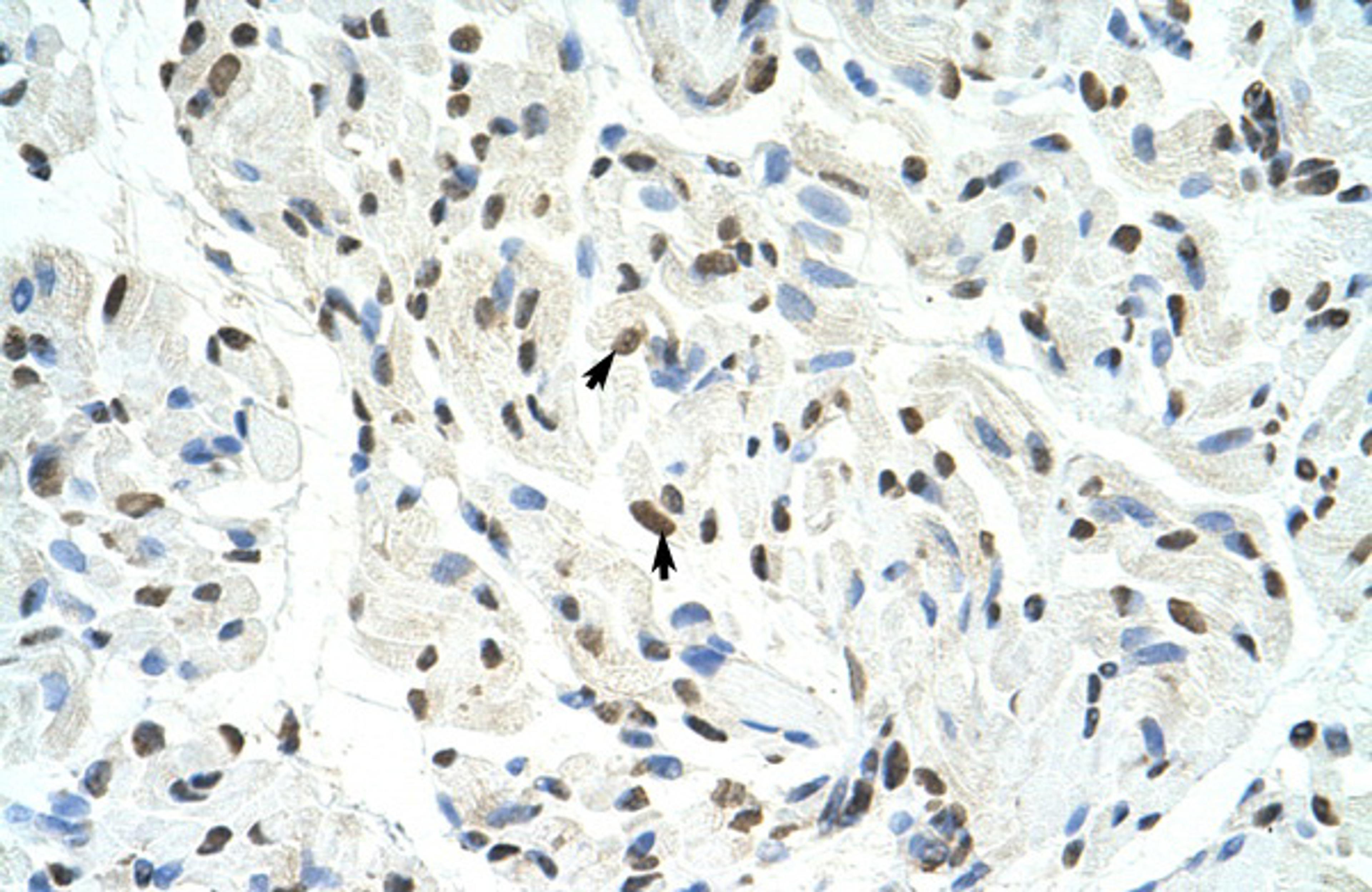 Antibody used in IHC on Human Muscle at 4.0-8.0 ug/ml.